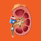 kidney-colic